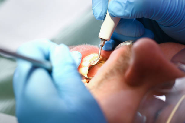 Best Emergency Treatment for Dental Infections or Abscesses in Belville, NC